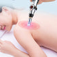 Acupun Pen - Electronic Acupuncture Pen